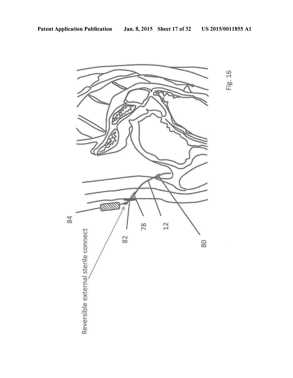 METHODS AND DEVICES FOR THE DIAGNOSIS AND TREATMENT OF DIABETES - diagram, schematic, and image 18