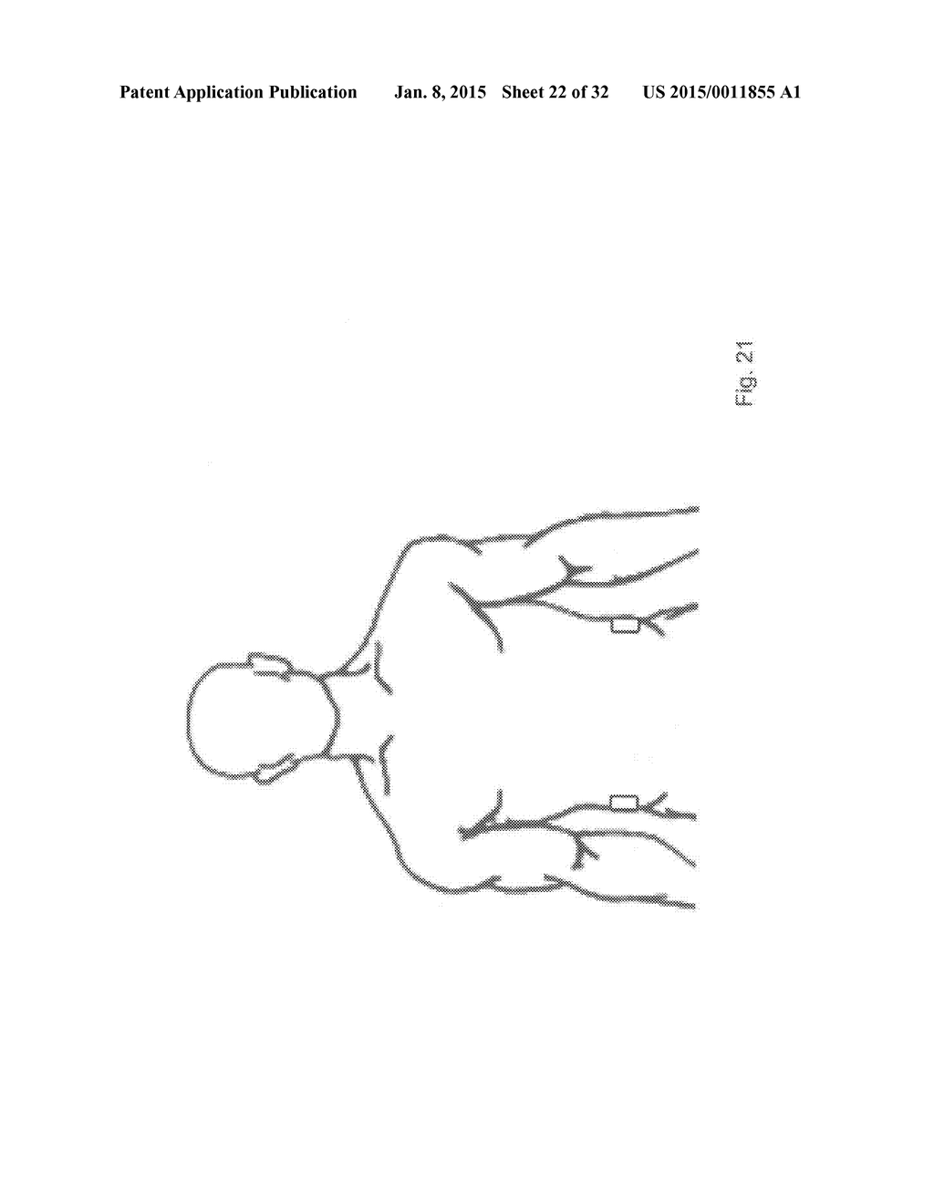 METHODS AND DEVICES FOR THE DIAGNOSIS AND TREATMENT OF DIABETES - diagram, schematic, and image 23