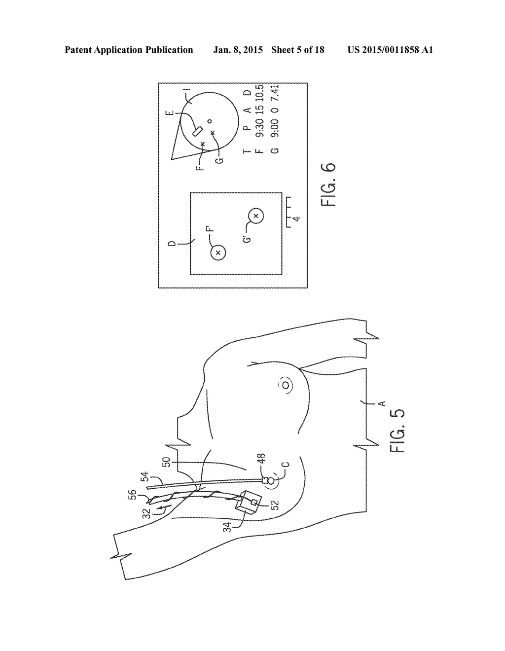 Sensor Attachment for Three Dimensional Mapping Display Systems for     Diagnostic Ultrasound Machines - diagram, schematic, and image 06