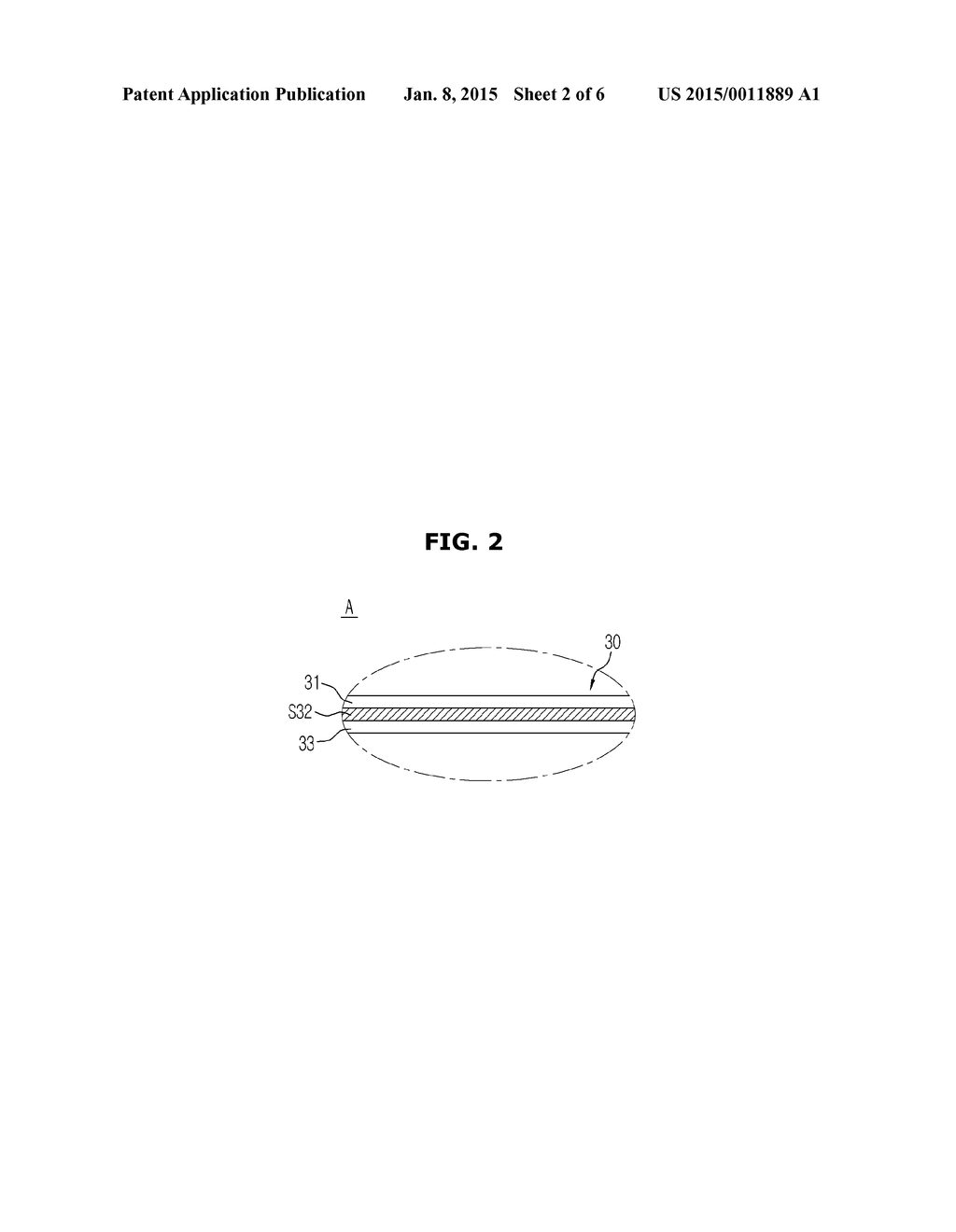 ULTRASONIC PROBE AND MANUFACTURING METHOD THEREOF - diagram, schematic, and image 03