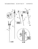 VIBRATING CATHETER LUER ACCESSORY diagram and image