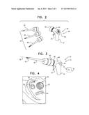 ROBOTIC SURGERY diagram and image