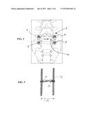 METHOD FOR STABILIZING THE SPINE diagram and image