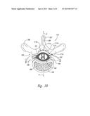 SYSTEMS AND METHODS FOR DETECTING INTRATHECAL PENETRATION diagram and image