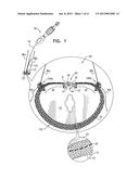 IMPLANT HAVING MULTIPLE ROTATIONAL ASSEMBLIES diagram and image