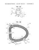 IMPLANT HAVING MULTIPLE ROTATIONAL ASSEMBLIES diagram and image