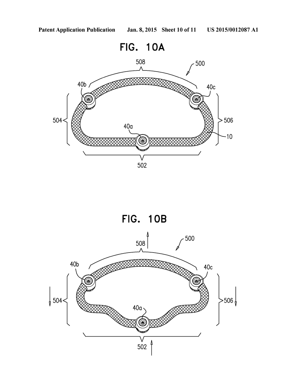 IMPLANT HAVING MULTIPLE ROTATIONAL ASSEMBLIES - diagram, schematic, and image 11