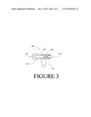 String suppressor for archery bows diagram and image