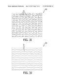 PATIENT INTERFACE DEVICE HAVING AN ENGINEERED SURFACE FOR PROVIDING LOW     FRICTION AND IMPROVED COMFORT TO THE USER diagram and image