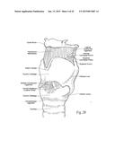 IMPLANTABLE DEVICES, SYSTEMS, AND METHODS FOR MAINTAINING DESIRED     ORIENTATIONS IN TARGETED TISSUE REGIONS diagram and image