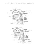 IMPLANTABLE DEVICES, SYSTEMS, AND METHODS FOR MAINTAINING DESIRED     ORIENTATIONS IN TARGETED TISSUE REGIONS diagram and image