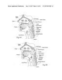 IMPLANTABLE DEVICES, SYSTEMS, AND METHODS FOR MAINTAINING DESIRED     ORIENTATIONS IN TARGETED TISSUE REGIONS diagram and image