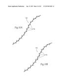 IMPLANTABLE DEVICES, SYSTEMS, AND METHODS FOR MAINTAINING DESIRED     ORIENTATIONS IN TARGETED TISSUE REGIONS diagram and image