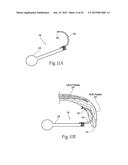 IMPLANTABLE DEVICES, SYSTEMS, AND METHODS FOR MAINTAINING DESIRED     ORIENTATIONS IN TARGETED TISSUE REGIONS diagram and image