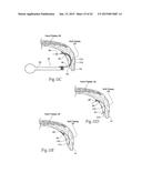 IMPLANTABLE DEVICES, SYSTEMS, AND METHODS FOR MAINTAINING DESIRED     ORIENTATIONS IN TARGETED TISSUE REGIONS diagram and image