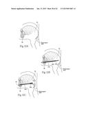 IMPLANTABLE DEVICES, SYSTEMS, AND METHODS FOR MAINTAINING DESIRED     ORIENTATIONS IN TARGETED TISSUE REGIONS diagram and image