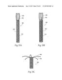 IMPLANTABLE DEVICES, SYSTEMS, AND METHODS FOR MAINTAINING DESIRED     ORIENTATIONS IN TARGETED TISSUE REGIONS diagram and image