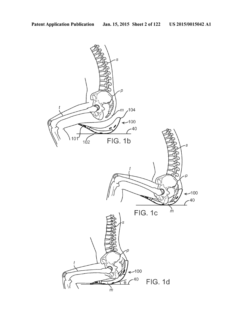 APPARATUS AND SYSTEM FOR DYNAMICALLY CORRECTING POSTURE - diagram, schematic, and image 03