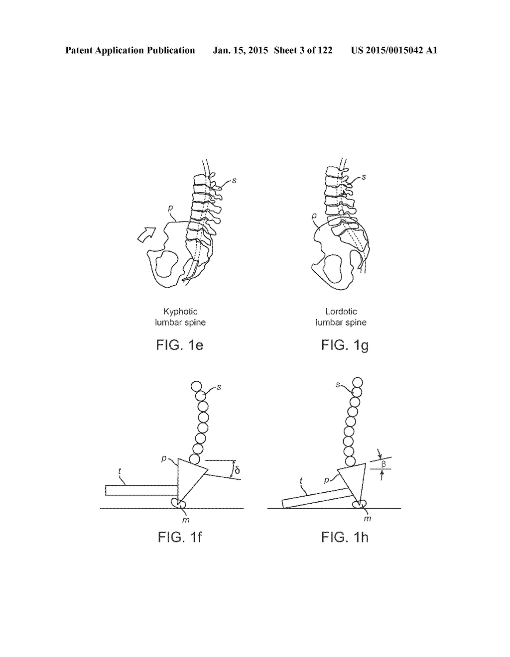 APPARATUS AND SYSTEM FOR DYNAMICALLY CORRECTING POSTURE - diagram, schematic, and image 04