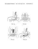 APPARATUS AND SYSTEM FOR DYNAMICALLY CORRECTING POSTURE diagram and image