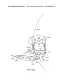 APPARATUS AND SYSTEM FOR DYNAMICALLY CORRECTING POSTURE diagram and image