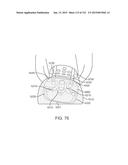 APPARATUS AND SYSTEM FOR DYNAMICALLY CORRECTING POSTURE diagram and image