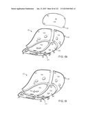 APPARATUS AND SYSTEM FOR DYNAMICALLY CORRECTING POSTURE diagram and image