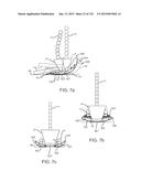 APPARATUS AND SYSTEM FOR DYNAMICALLY CORRECTING POSTURE diagram and image