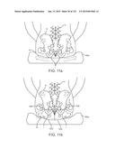 APPARATUS AND SYSTEM FOR DYNAMICALLY CORRECTING POSTURE diagram and image