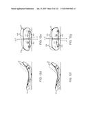 APPARATUS AND SYSTEM FOR DYNAMICALLY CORRECTING POSTURE diagram and image