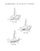 APPARATUS AND SYSTEM FOR DYNAMICALLY CORRECTING POSTURE diagram and image