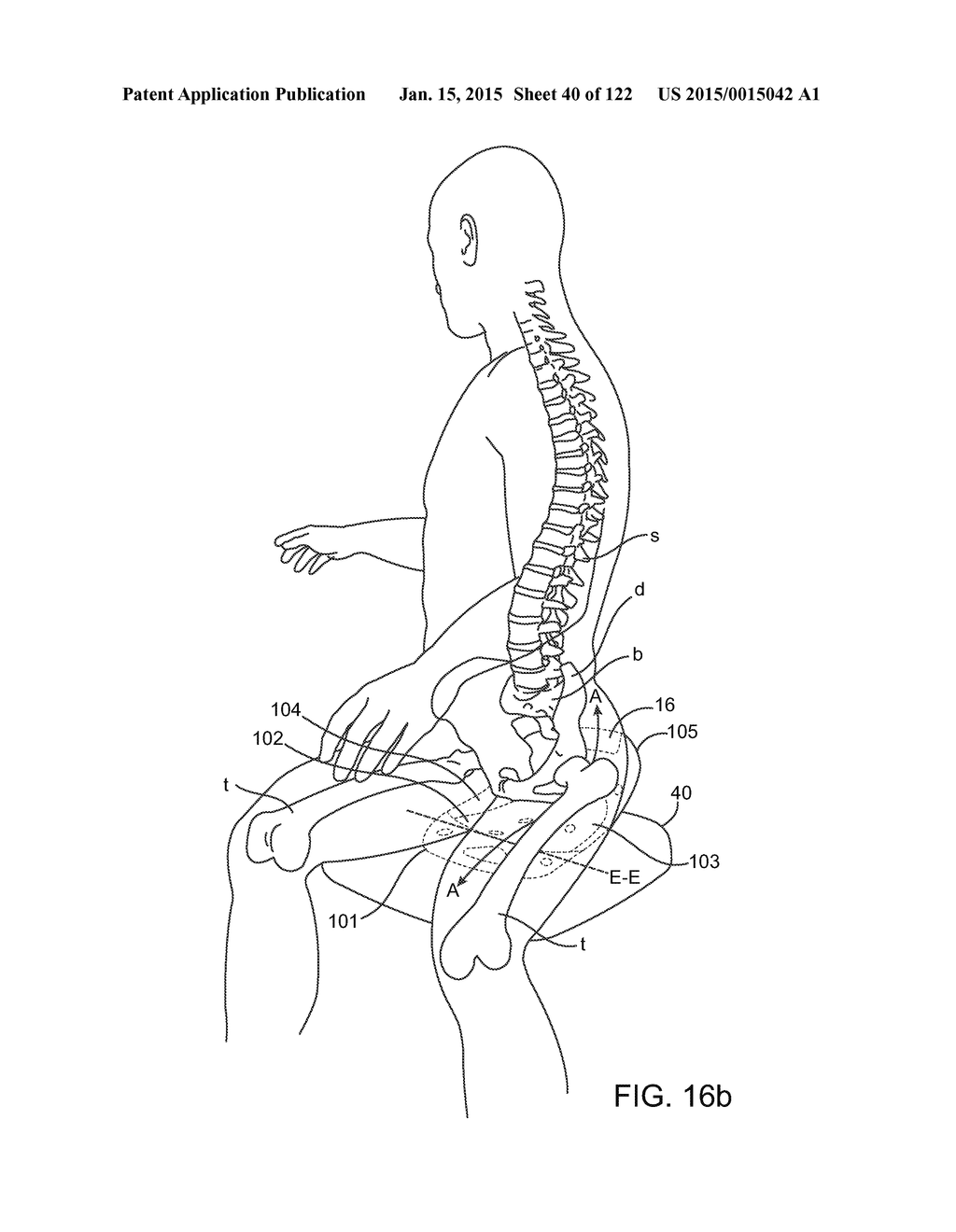 APPARATUS AND SYSTEM FOR DYNAMICALLY CORRECTING POSTURE - diagram, schematic, and image 41