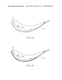 APPARATUS AND SYSTEM FOR DYNAMICALLY CORRECTING POSTURE diagram and image