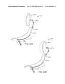 APPARATUS AND SYSTEM FOR DYNAMICALLY CORRECTING POSTURE diagram and image