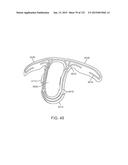 APPARATUS AND SYSTEM FOR DYNAMICALLY CORRECTING POSTURE diagram and image