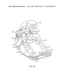 APPARATUS AND SYSTEM FOR DYNAMICALLY CORRECTING POSTURE diagram and image