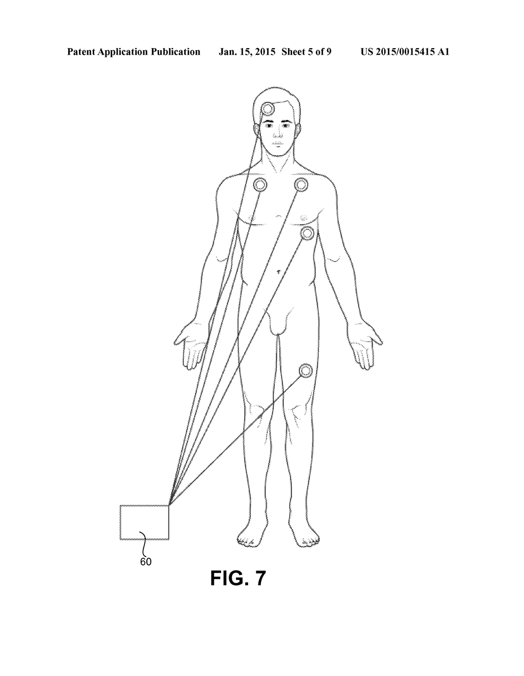 Nth Leadless Electrode Telemetry Device, System and Method of Use - diagram, schematic, and image 06