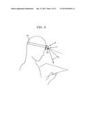 HEAD-MOUNTED FRONT ILLUMINATION DEVICE diagram and image