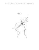 HEAD-MOUNTED FRONT ILLUMINATION DEVICE diagram and image