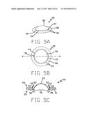 DISK DRIVE SUSPENSION ASSEMBLY HAVING A PARTIALLY FLANGELESS LOAD POINT     DIMPLE diagram and image