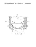 DISK DRIVE SUSPENSION ASSEMBLY HAVING A PARTIALLY FLANGELESS LOAD POINT     DIMPLE diagram and image