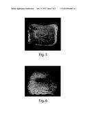 APPLICATOR FOR APPLYING COMPOSITIONS THAT SMOOTH WRINKLES AND SKIN TEXTURE     IMPERFECTIONS diagram and image