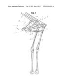 LOAD AND TORQUE RESISTANT CALIPER EXOSKELETON diagram and image