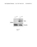 DETECTION AND TREATMENT OF METASTATIC DISEASE diagram and image