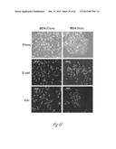 DETECTION AND TREATMENT OF METASTATIC DISEASE diagram and image