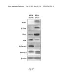 DETECTION AND TREATMENT OF METASTATIC DISEASE diagram and image