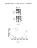 DETECTION AND TREATMENT OF METASTATIC DISEASE diagram and image