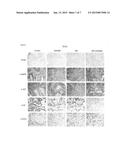 HER3 INHIBITOR FOR MODULATING RADIOSENSITIVITY diagram and image