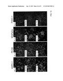 CARRIER THAT TARGETS FUCOSYLATED MOLECULE-PRODUCING CELLS diagram and image