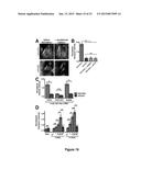 DIAGNOSIS AND TREATMENT FOR RESPIRATORY TRACT DISEASES diagram and image